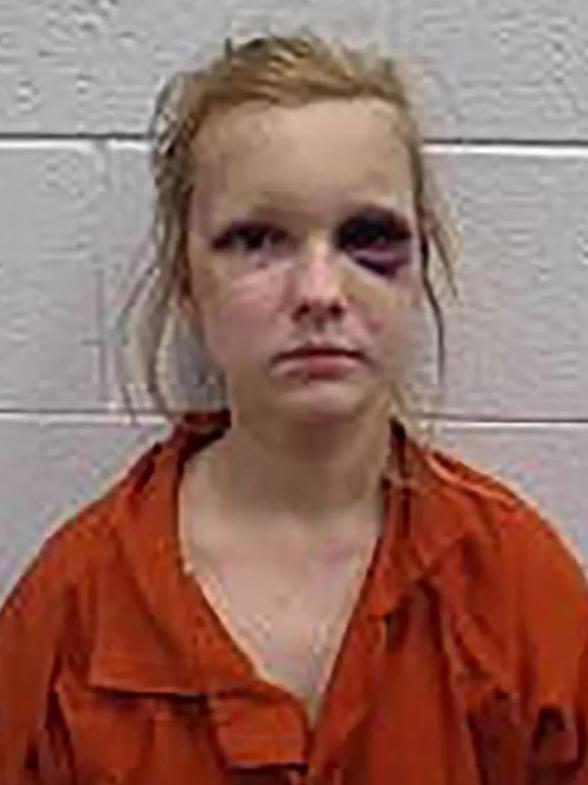 Ashley Rolland, 28, sports a big shiner in her booking photo.